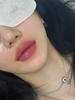 On the lips?