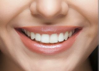 Straight teeth
