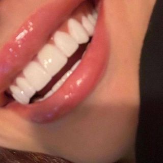 коплю на стоматолога!!!