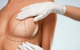 jessy wants to have a breast augmentation
