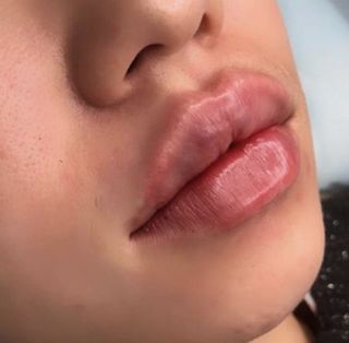 Lips
