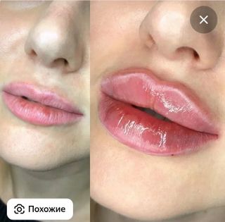 on the lips?
