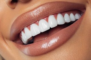 Perfect smile