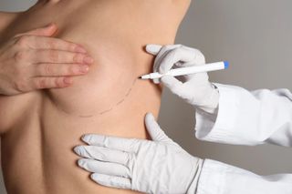 Breast surgery?