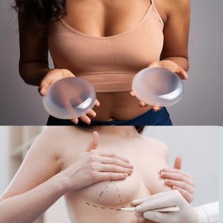 Breast implants