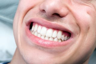Teeth