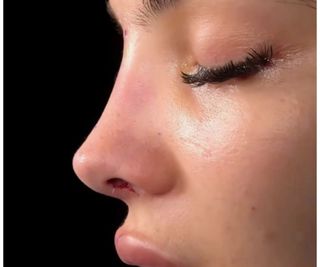 FUNCTIONAL AND Aesthetic RYNOPSY