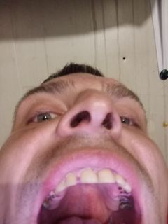 teeth