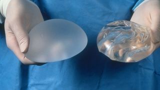 Breast Augmentation
