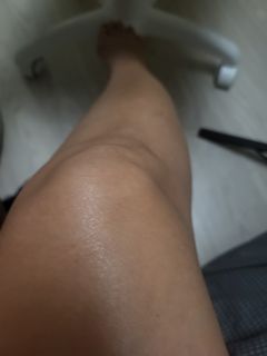 For surgery