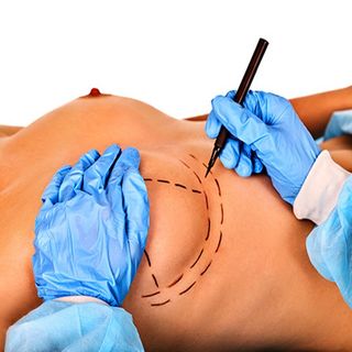 The aesthetic surgery of my dreams