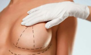 breast surgery